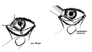 eyedrop and ointment application techniques